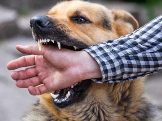 Làm Gì Khi Bị Chó Cắn - Hướng Dẫn Cách Sơ Cứu Khi Bị Chó Cắn